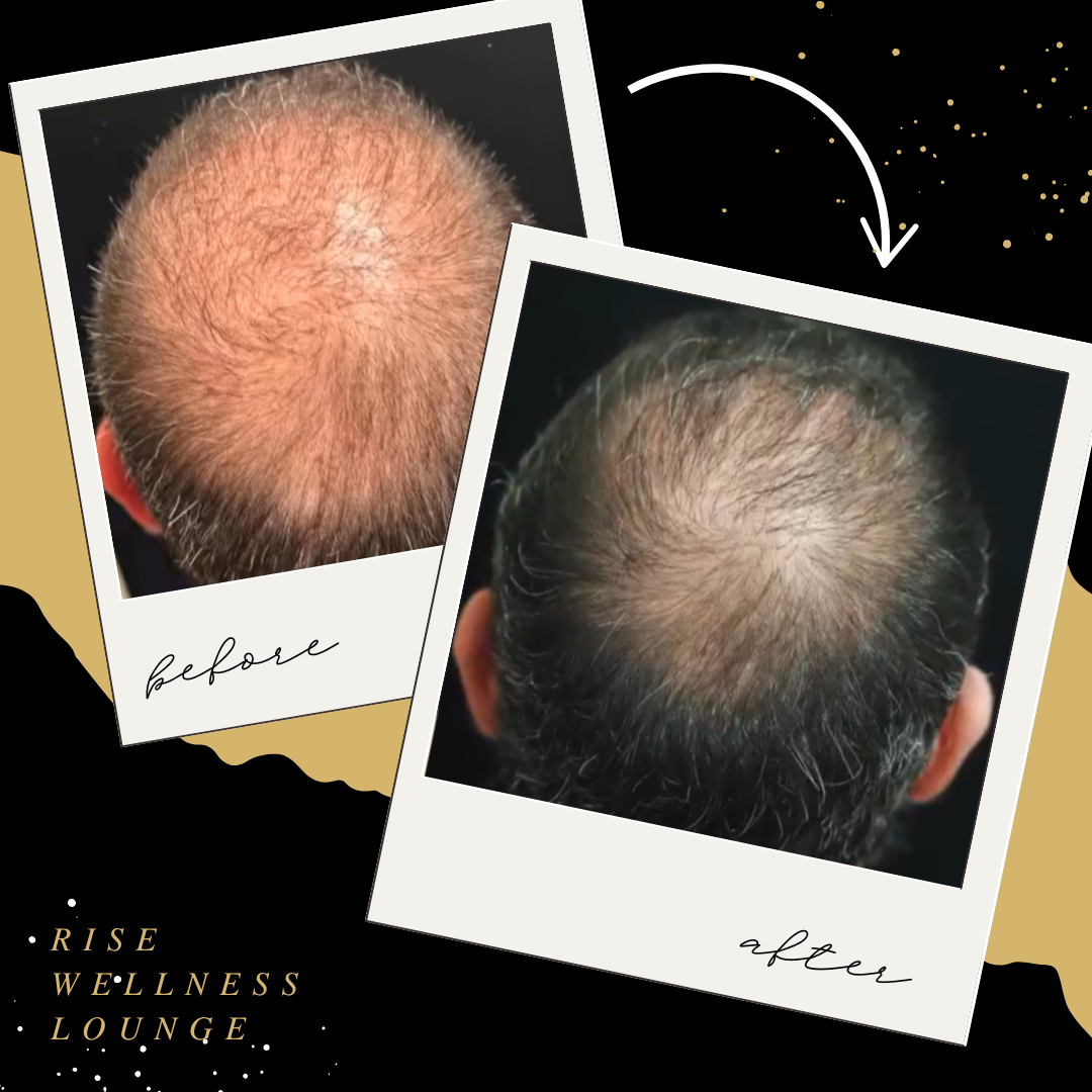 Beige Pink Minimal Elegant Tender Beauty Salon Before After Instagram Post